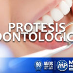 protesis-odontologicas
